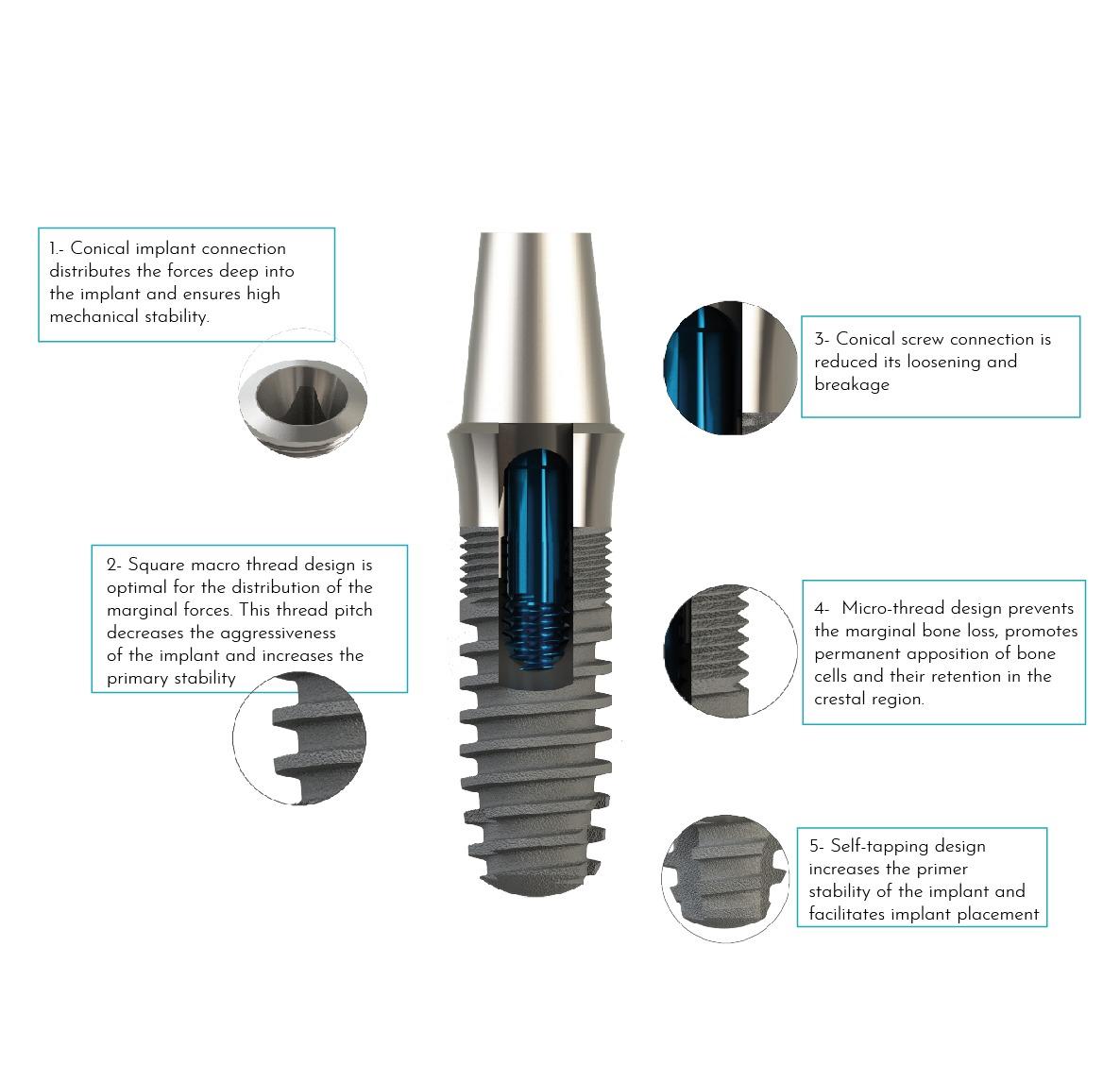 Tissue Level Implant - Bilimplant